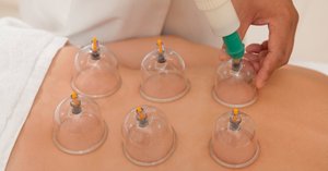 cupping.jpg